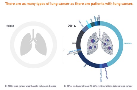 Types of Lung Cancer known in 2014